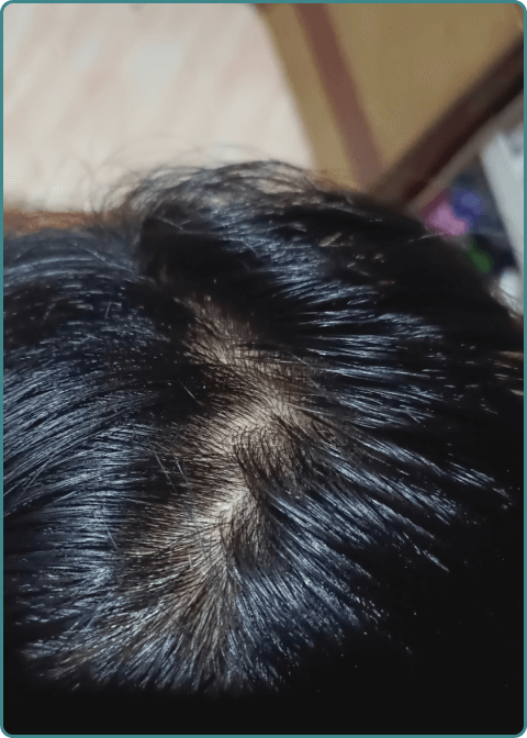 After