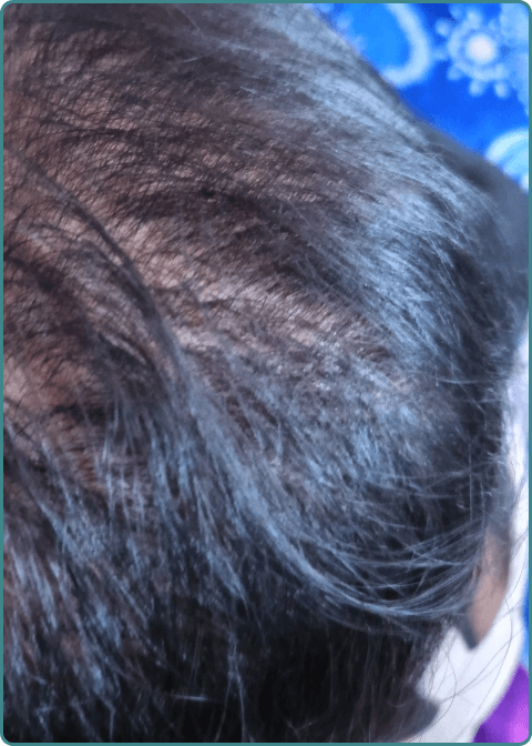 After