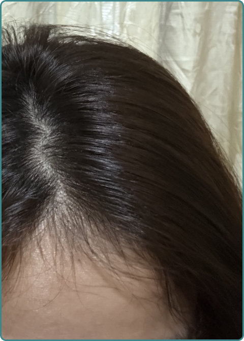 After